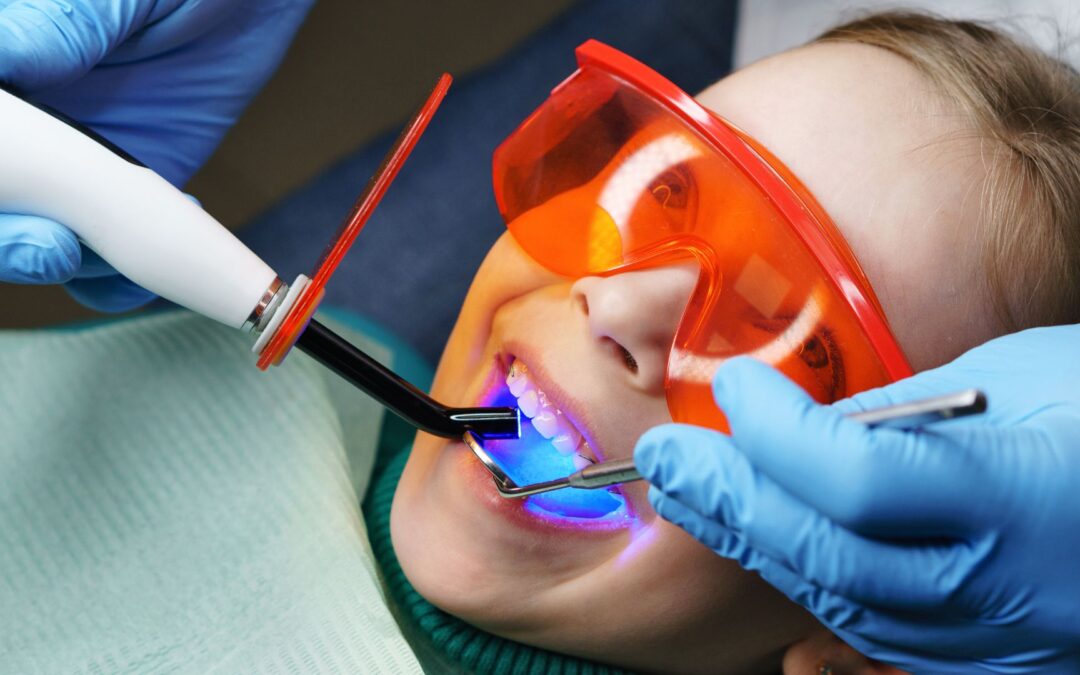 Signs Your Child Might Need a Dental Filling in Gilbert