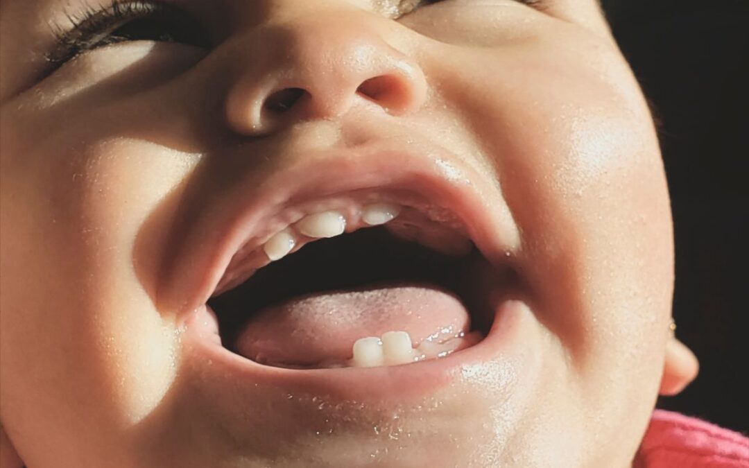 Baby’s First Tooth: Teething Signs, Symptoms & Pain Relief Remedies